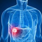 Ecalmpsia: maternal and fetal outcome
