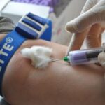 HIV-Sero- prevalence trend among blood donors in North East Ethiopia.
