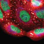 Oral dysbacteriosis in type 2 diabetes