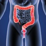 Association between ALDH2Glu504Lys polymorphism and colorectal cancer risk: a meta-analysis.