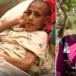 Management of human bites of the face in Enugu, Nigeria
