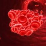 Epidemiological factors that promote