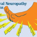 peripheral nephropathy symptoms
